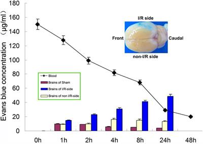 Resveratrol Delivery by Albumin Nanoparticles Improved Neurological Function and Neuronal Damage in Transient Middle Cerebral Artery Occlusion Rats